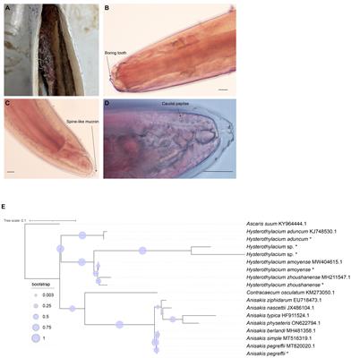 An investigation of the prevalence and diversity of Anisakis in China: marine food safety implications